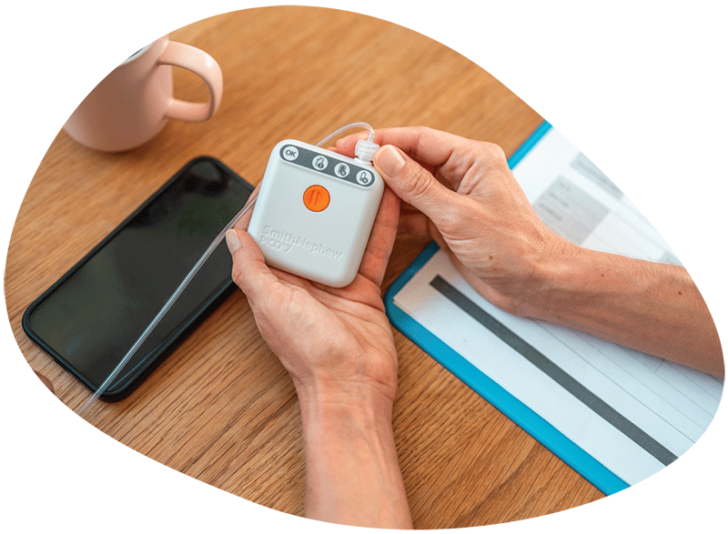 Hands holding PICO device