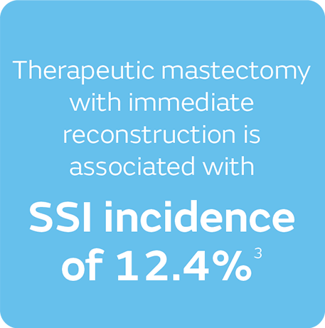 SI incidence of 12.4%