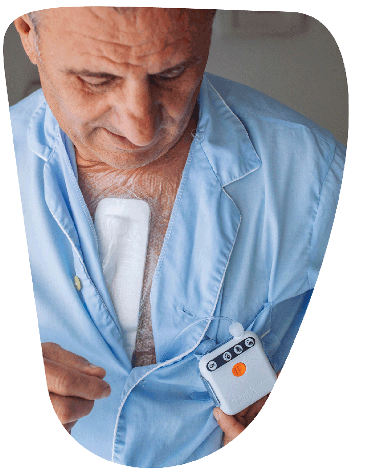 PICO on cardiac patient