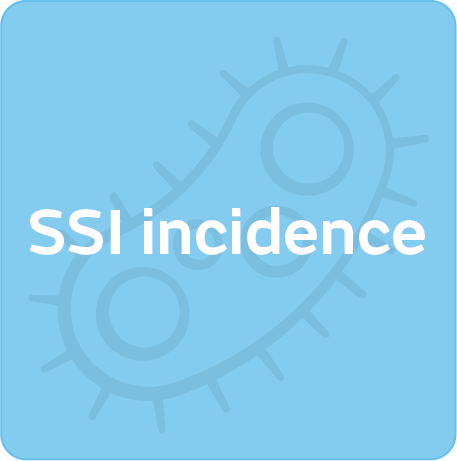 SSIs