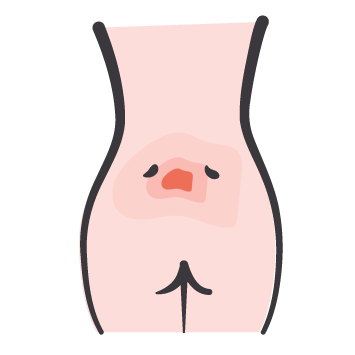 Pressure ulcer icon